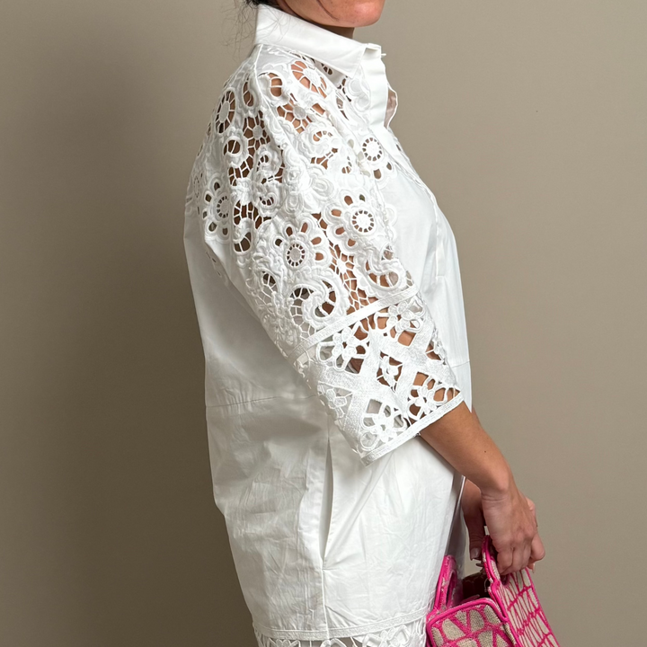 Lace Detailed Shirt Dress